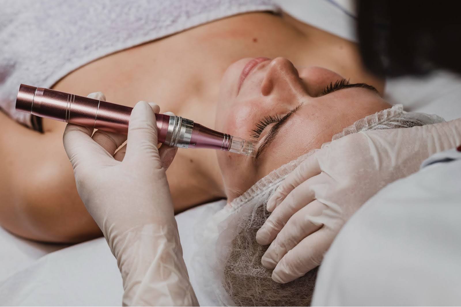 Find Top Microneedling Treatment Near Me | DermaCentre Pune