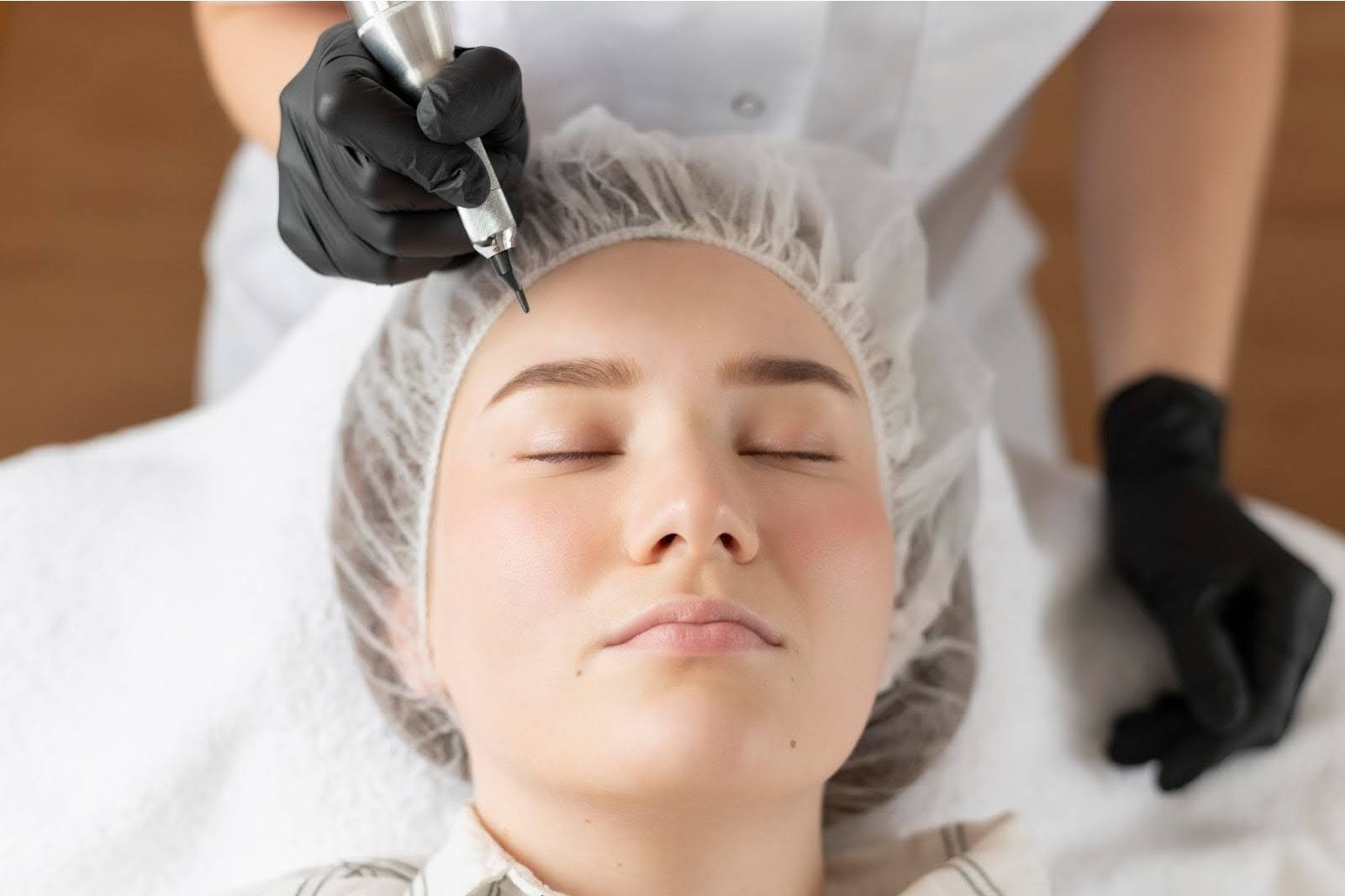 Top Microneedling Treatment in Pune | Wrinkles, Stretch Marks & More