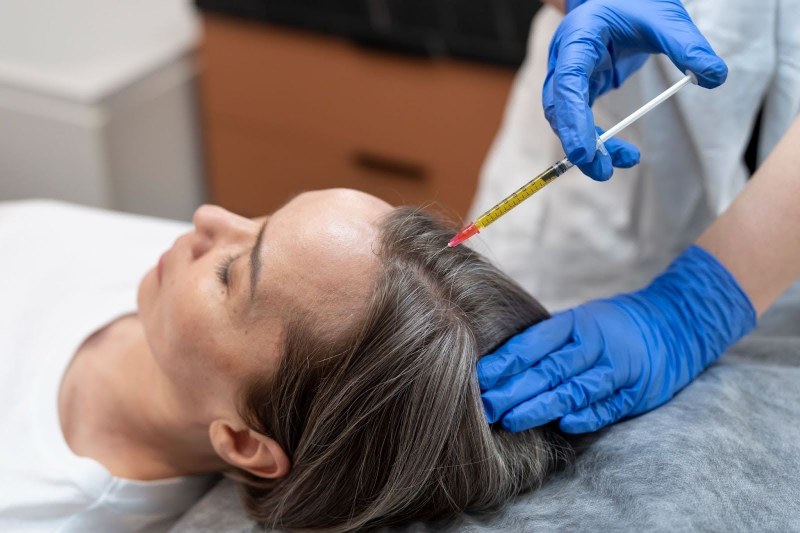 Hair fall treatment procedure at Derma Centre Pune using advanced dermatological techniques