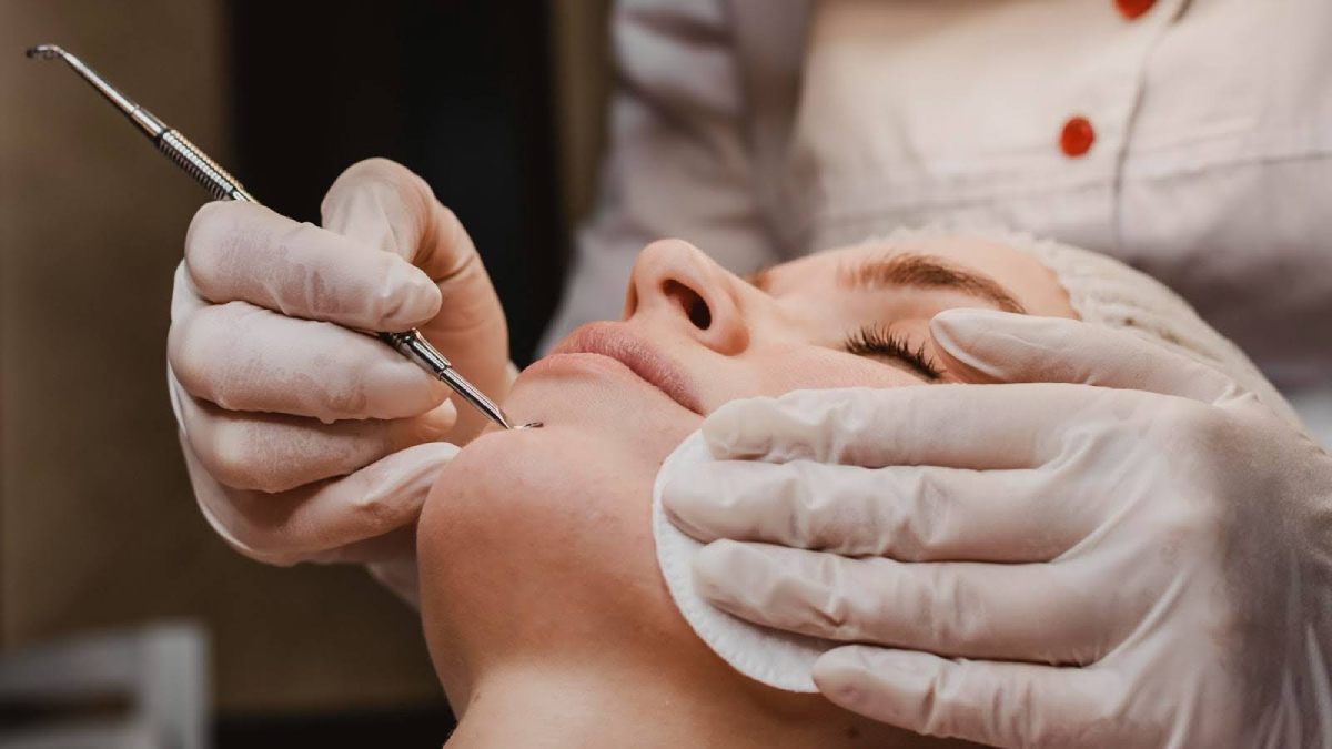 Say Goodbye to Pimples with the Best Pimple Removal Treatment