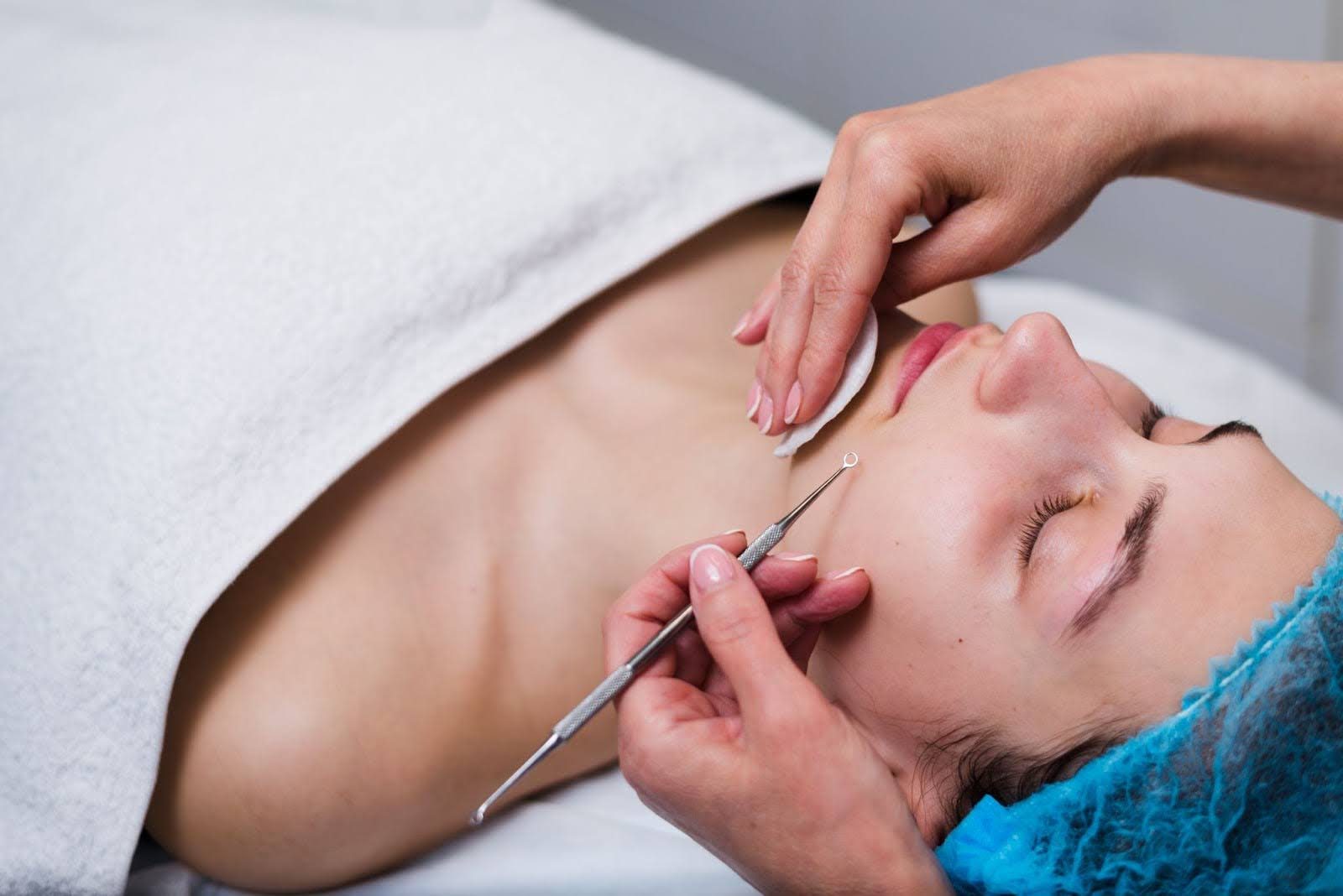 Open pores treatment with laser therapy at Derma Centre Pune