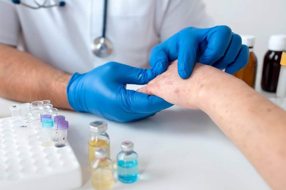 Planters Wart Removal Guide: Home Remedies & Medical Options
